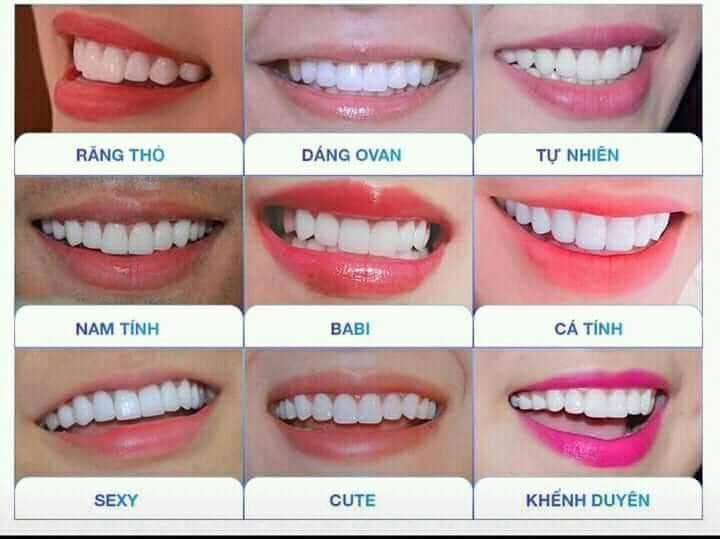 BẠN THÍCH DÁNG RĂNG NÀO?