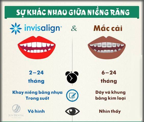 Niềng răng Invisalign sử dụng một loại khay trong suốt để điều chỉnh vị trí các răng trên cung hàm mà không cần đến dây và mắc cài kim loại