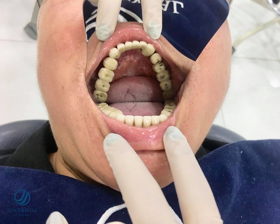 jun dental 256