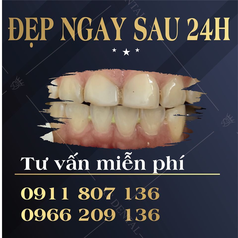 xs dental 65