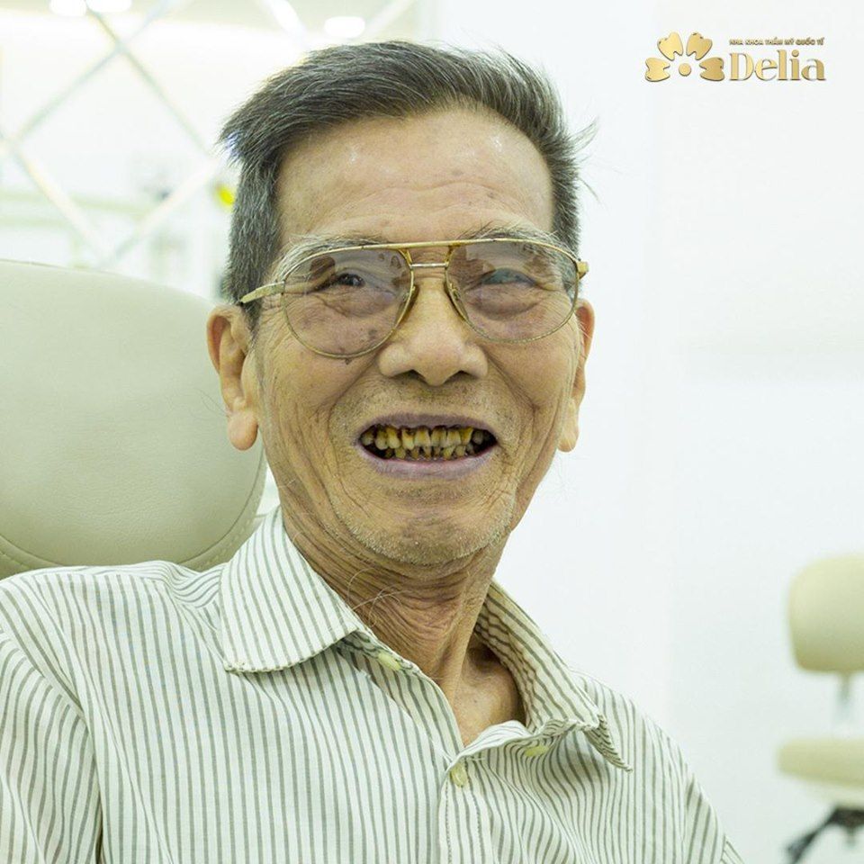 Sau phục hình 6 RĂNG đã mất tại Nha khoa Delia giúp cho việc ăn nhai được dễ dàng, thoải mái, niềm vui nối tiếp niềm vui khi mới đây Nghệ sĩ Trần Hạnh nhận danh hiệu Nghệ sĩ Nhân dân ở tuổi 90.