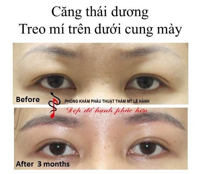 cang thai duong