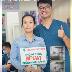 CẤY CHÂN RĂNG NHÂN TẠO IMPLANT - PHỤC HỒI ĂN NHAI HOÀN HẢO - NỤ CƯỜI TỰ TIN HƠN