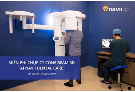 CHỤP X-QUANG RĂNG CONE BEAM 3D MIỄN PHÍ TẠI NAVII DENTAL CARE