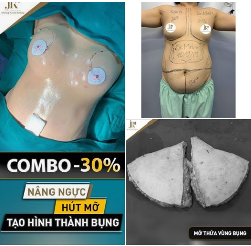 GIẢI CỨU VÒNG 1 TEO LÉP, VÒNG 2 XỒ XỀ " BIẾN HÓA" THÂN HÌNH ĐỒNG HỒ CÁT VỚI COMBO THẦN THÁNH