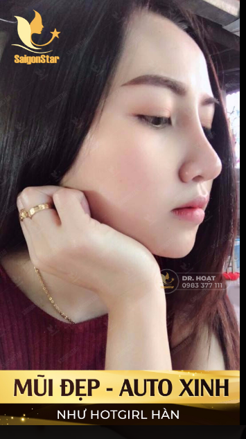 MŨI ĐẸP - AUTO XINH NHƯ HOTGIRL HÀN