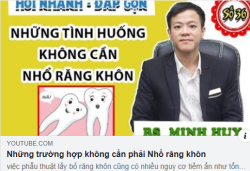 Những răng khôn nào thì không phải nhổ bỏ - Những bạn hiện đang có răng khôn nhất định phải xem