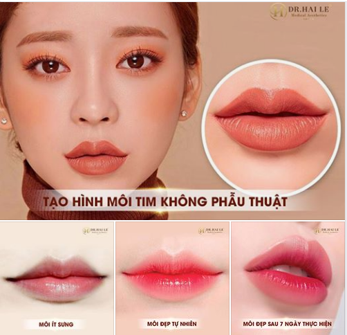 SỞ HỮU MÔI TIM KHÔNG CẦN PHẪU THUẬT ĐẸP CHUẨN TỪNG LY