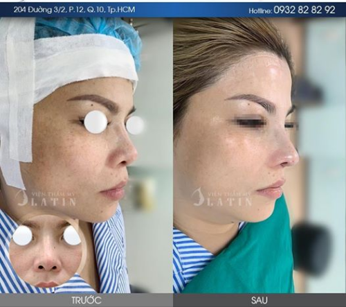 Thứ 2 đầu tuần, chúc cả nhà FB vui vẻ và tràn đầy năng lượng nhé! Ca combo đầu tiên khởi đầu tuần mới.