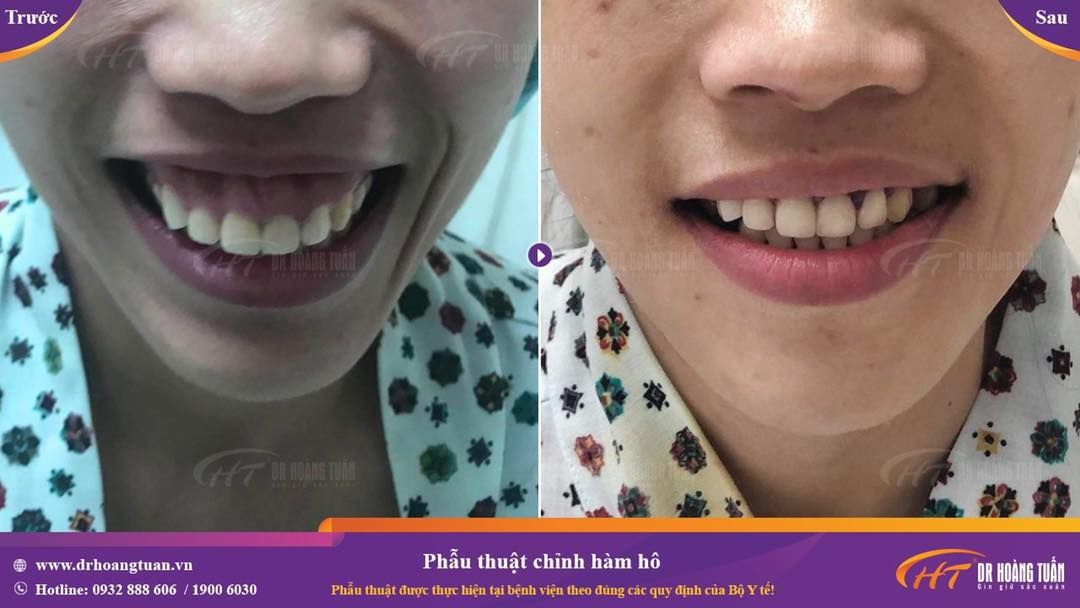 Ngày 6/9 với 5 ca đại phẫu