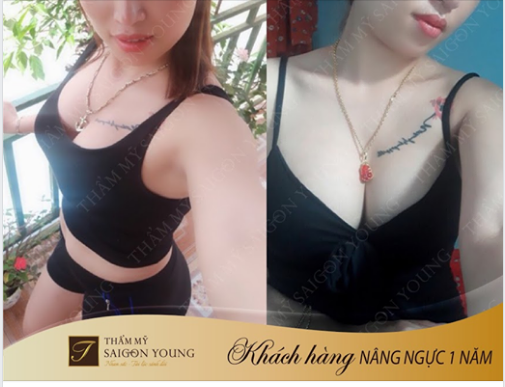 VÒNG 1 “SIÊU PHẲNG” KHÔNG CÒN LÀ NỖI LO