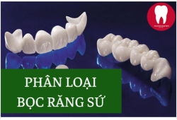 CÁC LOẠI BỌC RĂNG SỨ PHỔ BIẾN TRÊN THỊ TRƯỜNG HIỆN NAY