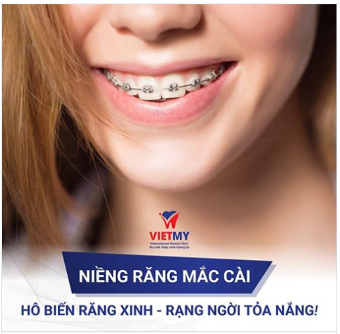 NIỀNG RĂNG MẮC CÀI SỨ - HÔ BIẾN RĂNG XINH - RẠNG NGỜI TỎA NẮNG