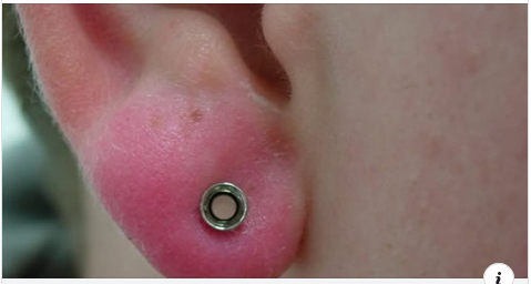  Việc xỏ khuyên tai ở vành tai trên đang ngày càng phổ biến hơn, đặc biệt là trong giới trẻ
