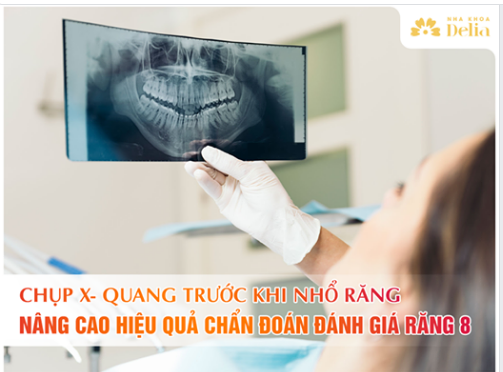 CHỤP X- QUANG TRƯỚC KHI NHỔ RĂNG - NÂNG CAO HIỆU QUẢ CHẨN ĐOÁN, ĐÁNH GIÁ RĂNG 8