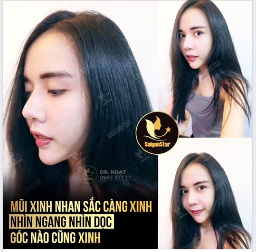  MŨI XINH NHAN SẮC CÀNG XINH