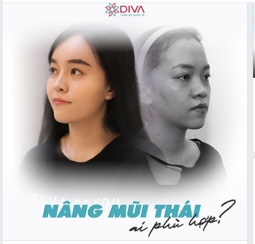 NÂNG MŨI THÁI – AI PHÙ HỢP