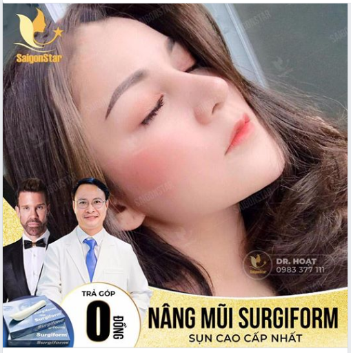 NÂNG MŨI  SURGIFORM - SỤN CAO CẤP NHẤT: ĐẸP + AN TOÀN + BỀN VỮNG