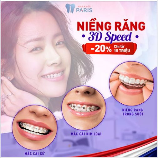 Tại sao niềng răng 3D Speed được đánh giá tốt tại nha khoa Paris?