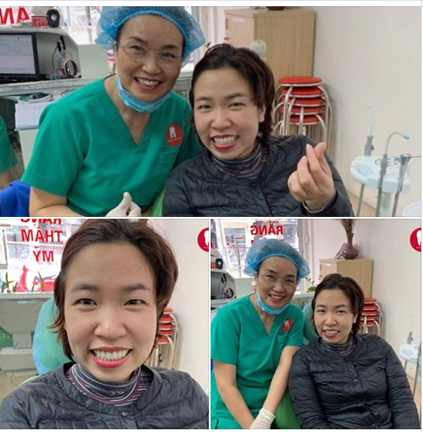 Nụ cười hạnh phúc trên khuôn mặt của bệnh nhân sau khi thực hiện làm răng thẩm mỹ tại Nha Khoa Ngọc Bích.