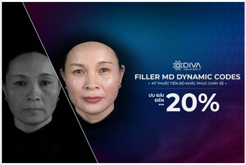  ĐIỀU TRỊ CHẢY XỆ, LÃO HÓA KHUÔN MẶT VỚI FILLER MD DYNAMIC CODES