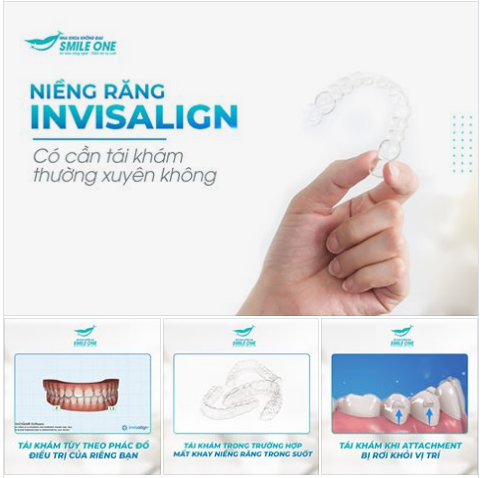 Niềng răng Invisalign có cần tái khám thường xuyên như niềng răng mắc cài?