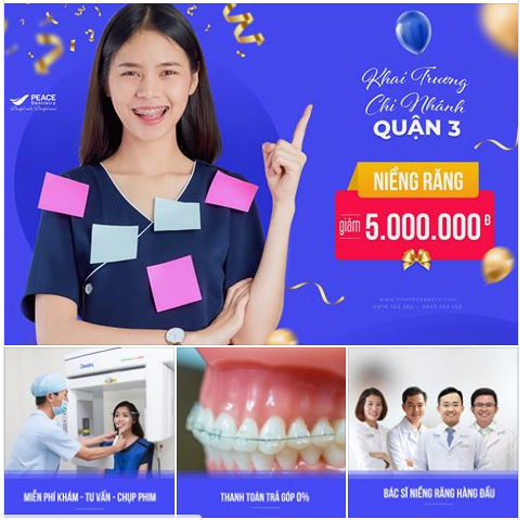 Ưu đãi ngay 5.000.000đ khi Niềng răng – Mừng khai trương Peace Dentistry quận 3