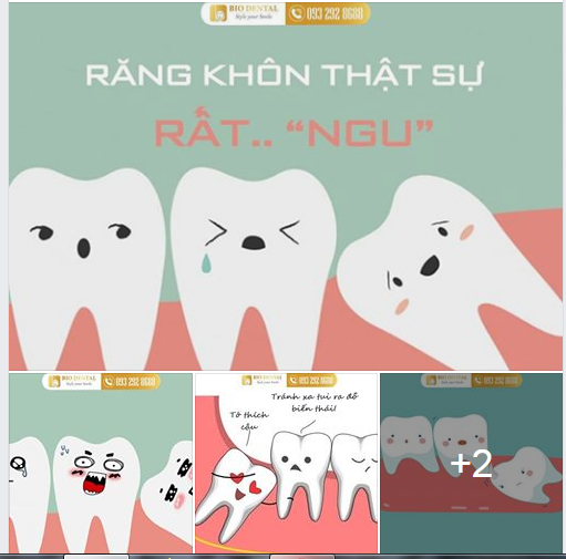 Răng KHÔN và những pha mọc "NGU KHÔNG TƯỞNG" 