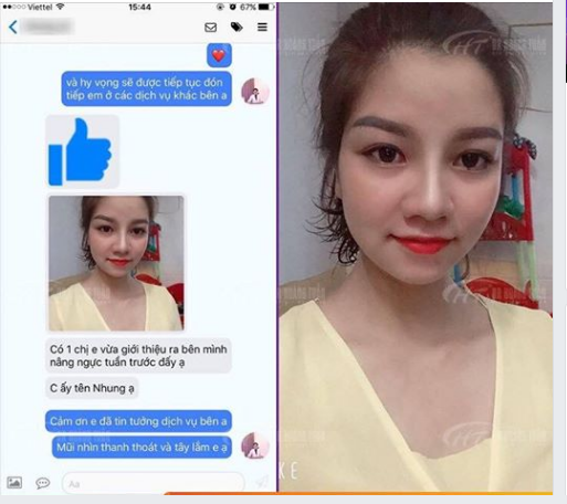 Sau 7 tháng nâng mũi Sline Dr Hoàng Tuấn, khách hàng gửi feedback cho các chị em cùng tham khảo luôn nhé!
