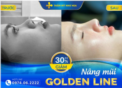 1 GÓC NHÌN NHƯNG 2 SỐ PHẬN