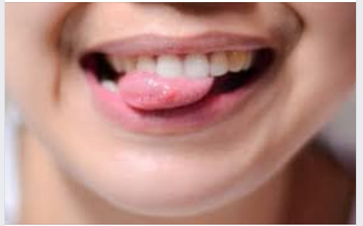 5 thói quen xấu đang đe doạ sức khoẻ răng miệng của bé