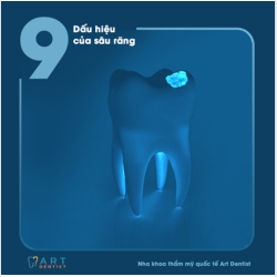 9 DẤU HIỆU CỦA SÂU RĂNG