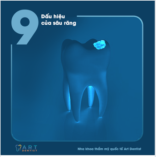 9 DẤU HIỆU CỦA SÂU RĂNG