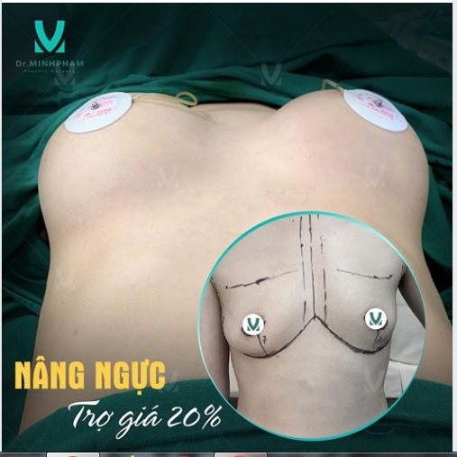 CAM SÀNH LỘT VỎ CÒN CHUA NGỰC MÀ KHÔNG CÓ SAO CUA ĐƯỢC CHÀNG