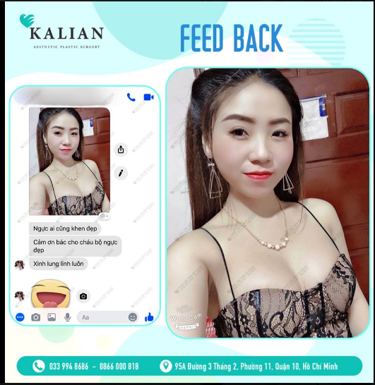 Chuyên mục FEEDBACK quyến rũ từ khách hàng NÂNG VÒNG 1 NỘI SOI sau 2 tháng của Kalian, hy vọng mọi người luôn xinh đẹp tự tin