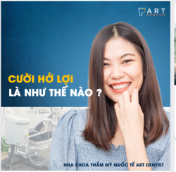 CƯỜI HỞ LỢI LÀ NHƯ THẾ NÀO