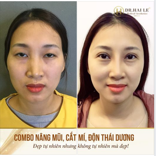 ĐẸP TỰ NHIÊN NHƯNG KHÔNG TỰ NHIÊN MÀ ĐẸP‼️