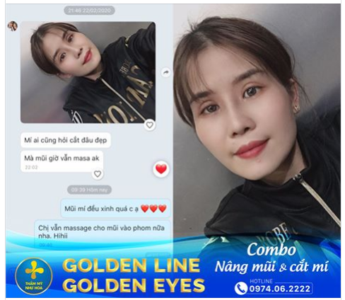 FEEDBACK KHÁCH LÀM MŨI - MÍ NGÀY THỨ 17