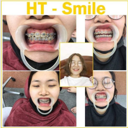 NIỀNG RĂNG THAY ĐỔI NHỮNG GÌ MÀ KHIẾN BẠN ĐẸP HƠN 