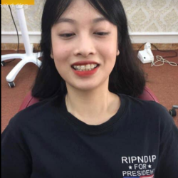  Phía sau một nụ cười đẹp Là một phương pháp thẩm mỹ an toàn