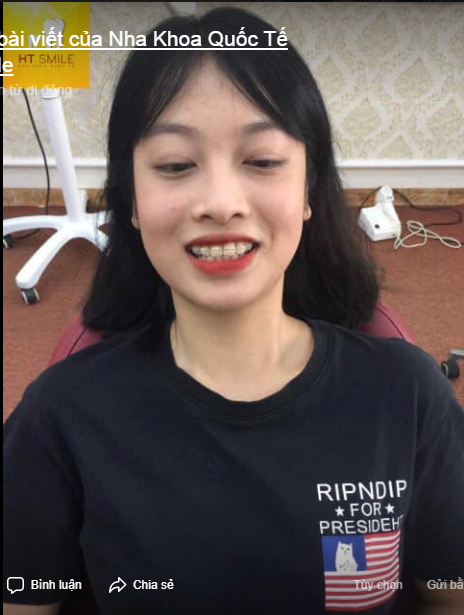  Phía sau một nụ cười đẹp Là một phương pháp thẩm mỹ an toàn