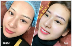 Phun mày SƯƠNG SƯƠNG thế này đã đủ làm chị em SAY ĐẮM.