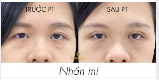 Trong rừng gươm cũng có hoa hồng, và Charming cũng vô cùng may mắn khi sở hữu một trong những đóa hồng quý hiếm ấy.