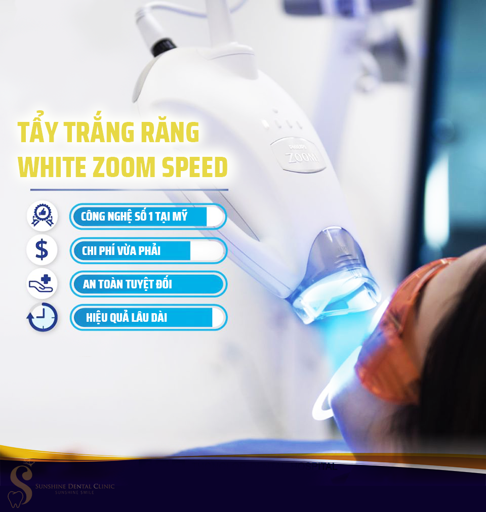 MÓN QUÀ Ý NGHĨA CHO NGƯỜI THÂN - Philips White Zoom Speed