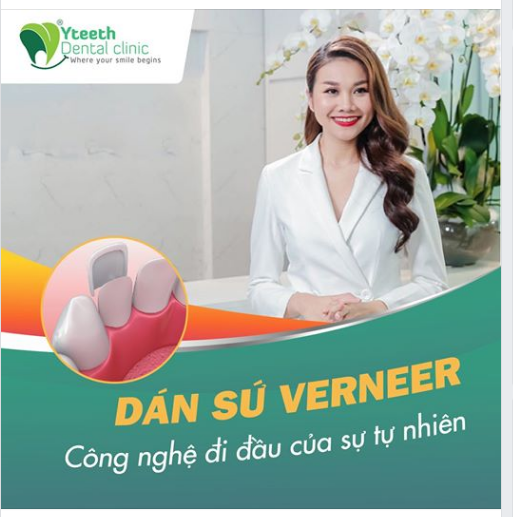 DÁN SỨ VERNEER - CÔNG NGHỆ ĐI ĐẦU CỦA SỰ TỰ NHIÊN TRONG PHƯƠNG PHÁP PHỤC HÌNH RĂNG THẨM MỸ TRÊN THẾ GIỚI