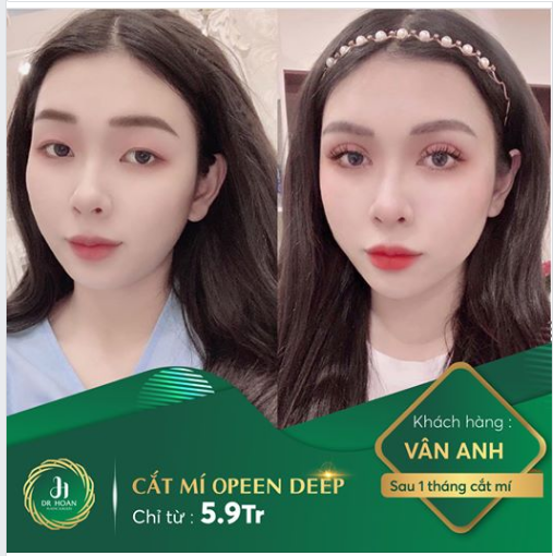 Mí trung đông hút hồn sắc sảo cho các bạn cá tính yêu thích sự quyến rũ.