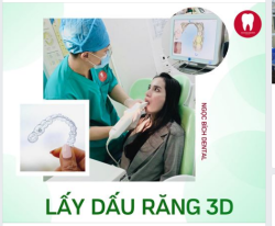  Niềng răng: tại sao hình ảnh 3D tốt hơn dấu răng thủ công?