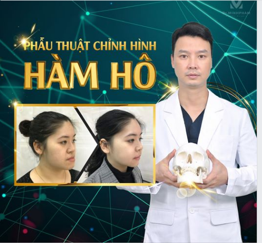 Phẫu thuật chỉnh hàm - khuôn mặt không cân xứng cùng Dr Minh Phạm 108