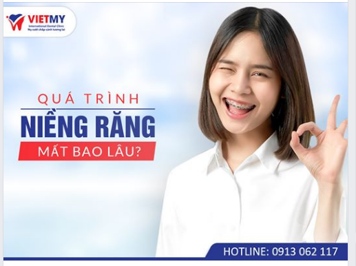 QUÁ TRÌNH NIỀNG RĂNG MẤT BAO LÂU