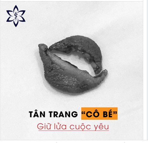 Tan Trang C O B E Giữ Lửa Cuộc Y E U